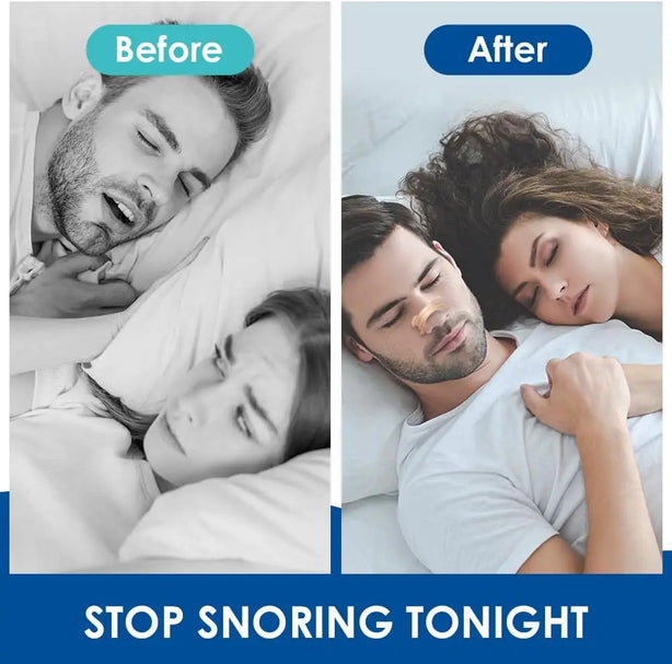 Breathe Nasal Strips to Reduce Snoring Improve Sleep Relieve Nasal Congestion Colds Allergies Easier Breath Open Nasal Passages